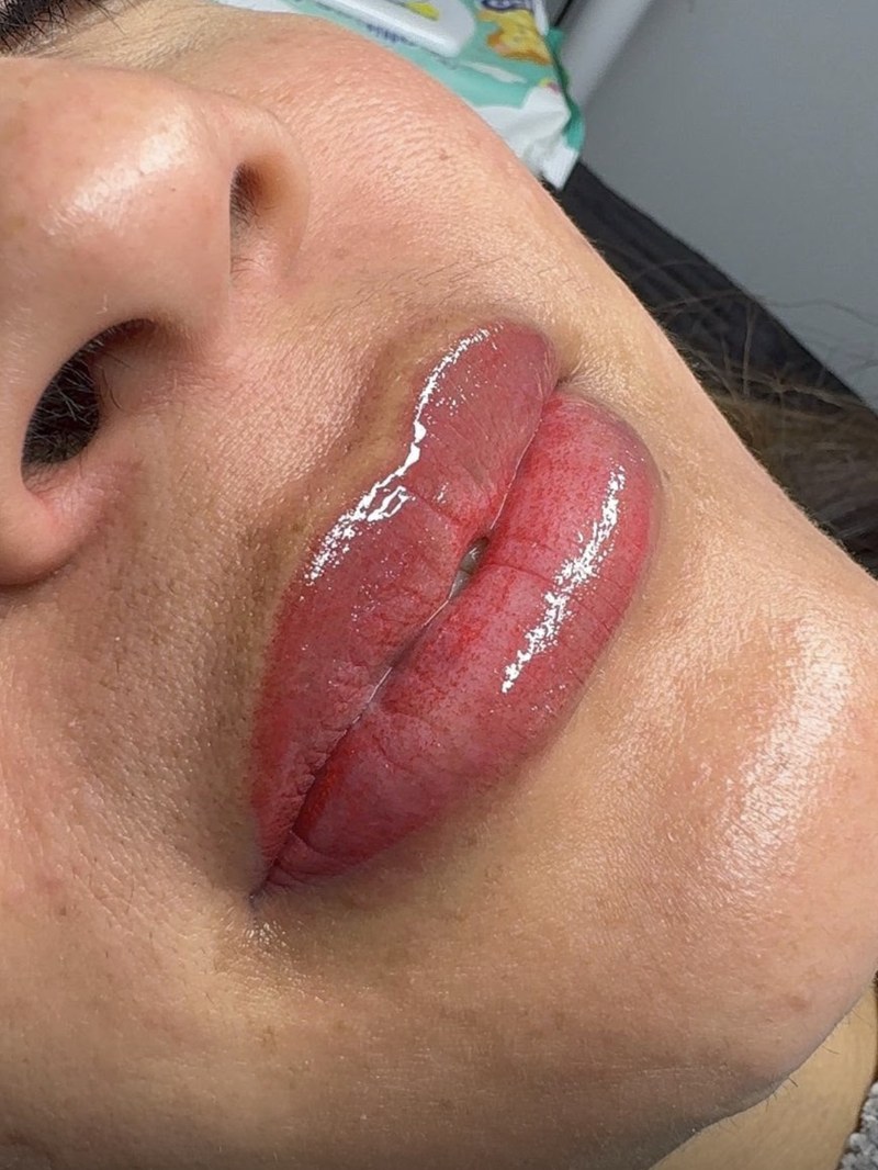 Microlips